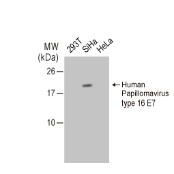 Human Papilloma Virus type 16 E7 antibody (GTX133411)