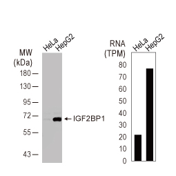 IGF2BP1 antibody (GTX134816)