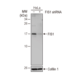FIS1 antibody [GT9810] (GTX631209)