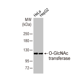 O-GlcNAc transferase antibody [HL1641] (GTX637222)