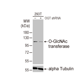 O-GlcNAc transferase antibody [HL1642] (GTX637223)