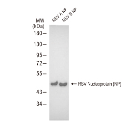 Respiratory Syncytial Virus type A Nucleoprotein, DDDDK tag (GTX136751-pro)