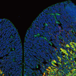 DLK/MAP3K12 antibody (GTX124127)