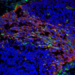 Visinin-like 1 antibody (GTX115039)