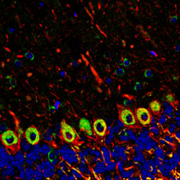 DLGAP1 antibody (GTX133264)