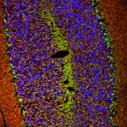 HCN1 antibody (GTX131334)