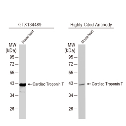 Cardiac Troponin T antibody (GTX134489)