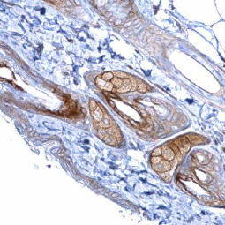 Desmoglein 2 antibody [N1N2], N-term (GTX102508)