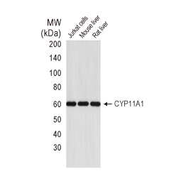 CYP11A1 antibody (GTX56293)