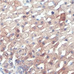 StAR antibody [HL1360] (GTX636800)