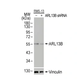 ARL13B antibody [HL2173] (GTX638177)