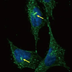 ARL13B antibody [HL2173] (GTX638177)