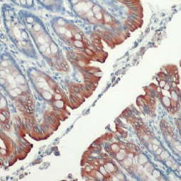 Cytokeratin 19 antibody [HL1165] (GTX636469)