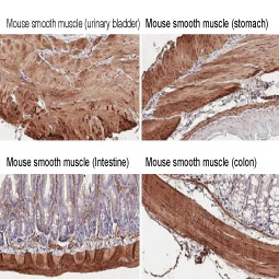 alpha Smooth Muscle Actin antibody [HL1419] (GTX636885)