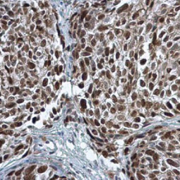 PCNA antibody (GTX100539) 