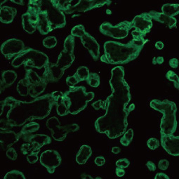 pan Cytokeratin antibody [PCK-26] (GTX26401)
