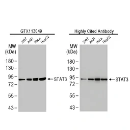 STAT3 antibody [HL1134] (GTX636400) 