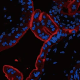 PD-L1 antibody [HL1041] (GTX635975)