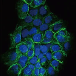 CD44 antibody [HL1650] (GTX637231)