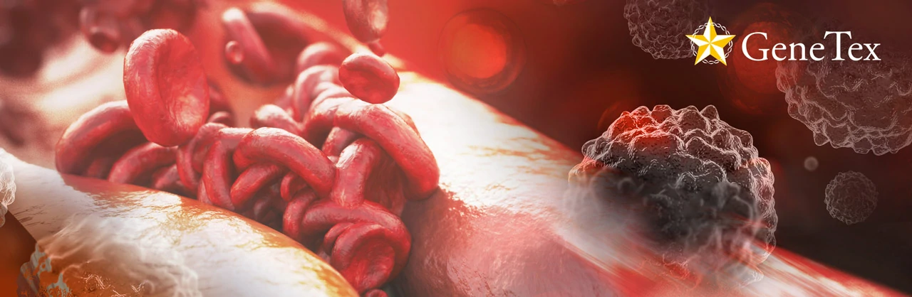 Article Alert: Ischemic Heart Failure Suppresses Tumor Cell Susceptibility to Ferroptosis through an Exosome-Mediated Pathway