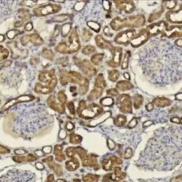 CXCL14 antibody [N3C3] (GTX108431)