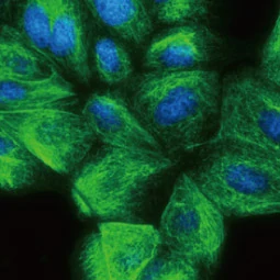 Vimentin antibody (GTX100619)