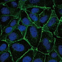 E-Cadherin antibody (GTX100443)