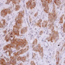MMP12 antibody [N3C1], Internal (GTX100704)