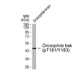 JNK (phospho Thr183/Tyr185) antibody (GTX133934)