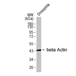 beta Actin antibody [HL1926] (GTX637675) 