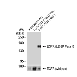 EGFR (L858R Mutant) antibody [HL1022] (GTX635834)