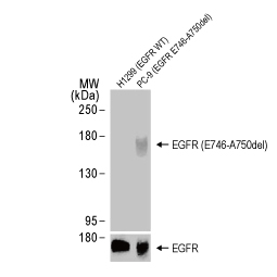 EGFR (E746-A750del) antibody [HL363] (GTX635716)