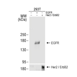 EGFR antibody [GT133] (GTX628887)