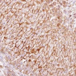 SCAMP3 antibody [N1N3] (GTX102216)