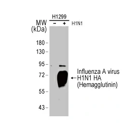 Influenza A virus H1N1 HA (Hemagglutinin) antibody (GTX127357) 