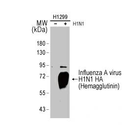 Influenza A virus H1N1 HA (Hemagglutinin) antibody (GTX127357) Influenza A virus H1N1 HA (Hemagglutinin) antibody (GTX127357)