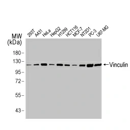 Vinculin antibody [HL1873] (GTX637622)