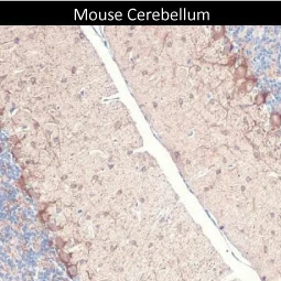 GAD67 antibody [HL1096] (GTX636280)