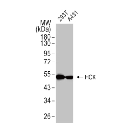 HCK antibody [HL1673] (GTX637272)