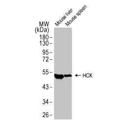 HCK antibody [HL1673] (GTX637272)