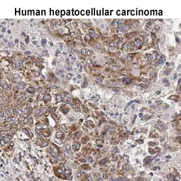 HCK antibody [HL1673] (GTX637272)