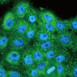 HPV16 E7 antibody [HL1647] (GTX637228)