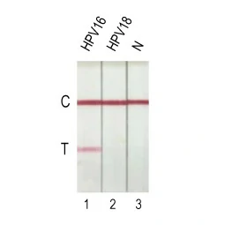 HPV16 E7 antibody [HL1647] (GTX637228)