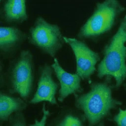 GAD65 antibody [HL1187] (GTX636493)