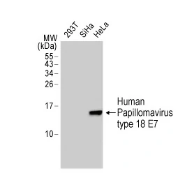 HPV18 E7 antibody [GT881] (GTX634337)