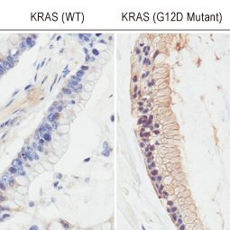 RAS (G12D Mutant) antibody [HL10] (GTX635362)