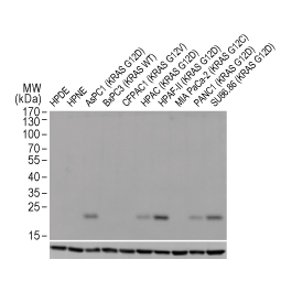 RAS (G12D Mutant) antibody [HL10] (GTX635362)