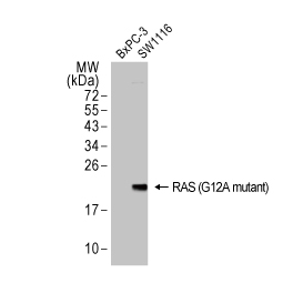 RAS (G12A Mutant) antibody [HL1153] (GTX636434)