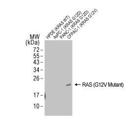 RAS (G12V Mutant) antibody [HL169] (GTX635623)