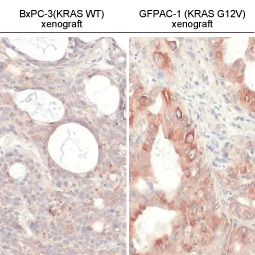 RAS (G12V Mutant) antibody [HL169] (GTX635623)